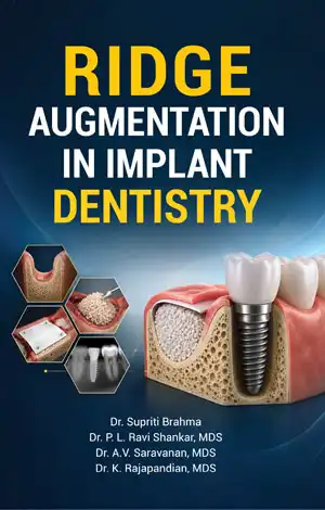 Ridge Augmentation in Implant Dentistry