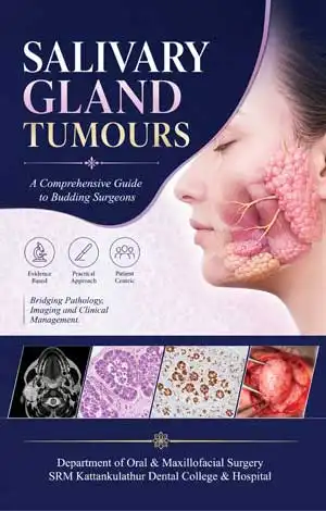 Salivary Gland Tumours