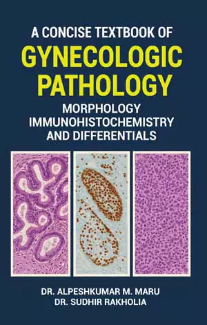 A Concise Textbook of Gynecologic Pathology: Morphology, Immunohistochemistry, and Differentials